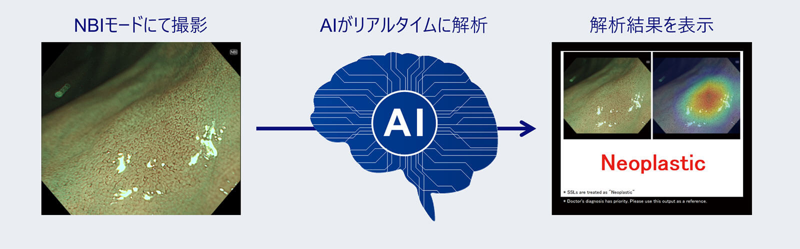5.4mm経鼻内視鏡