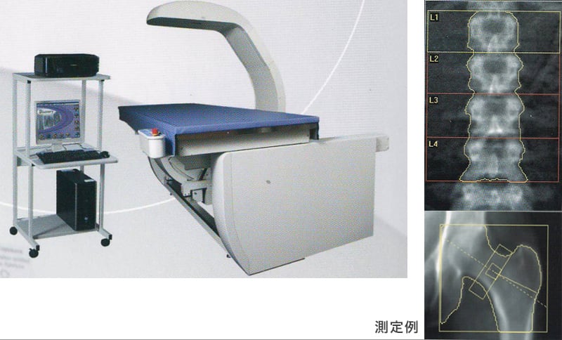 骨密度測定装置